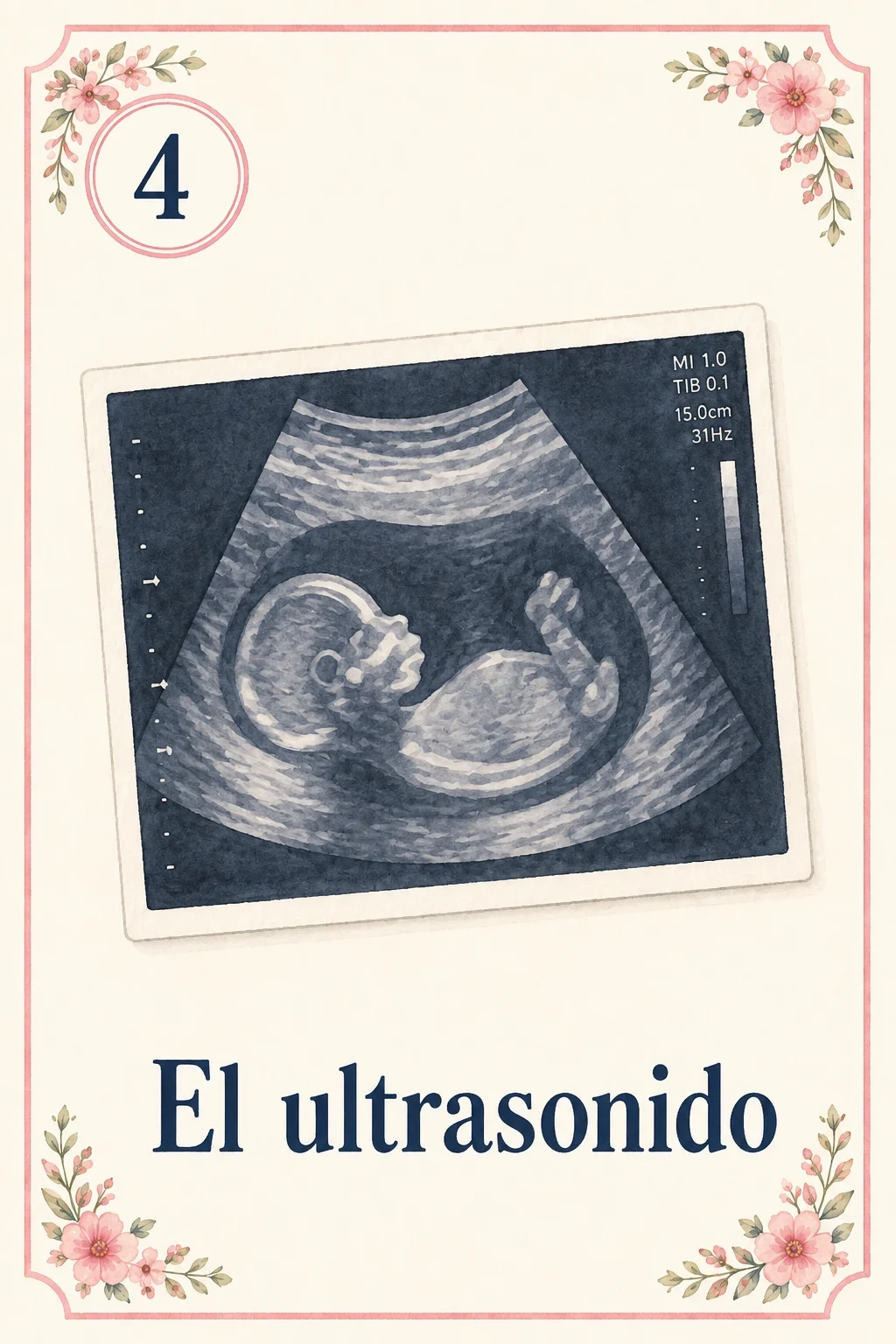 El ultrasonido